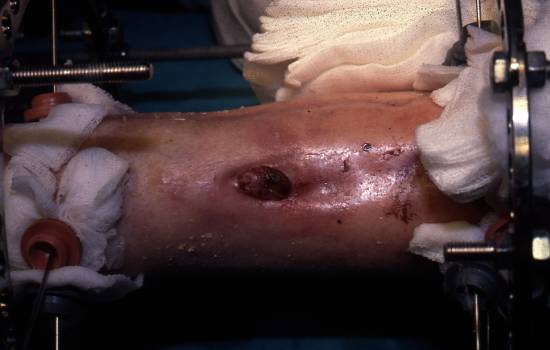 Przed leczeniem